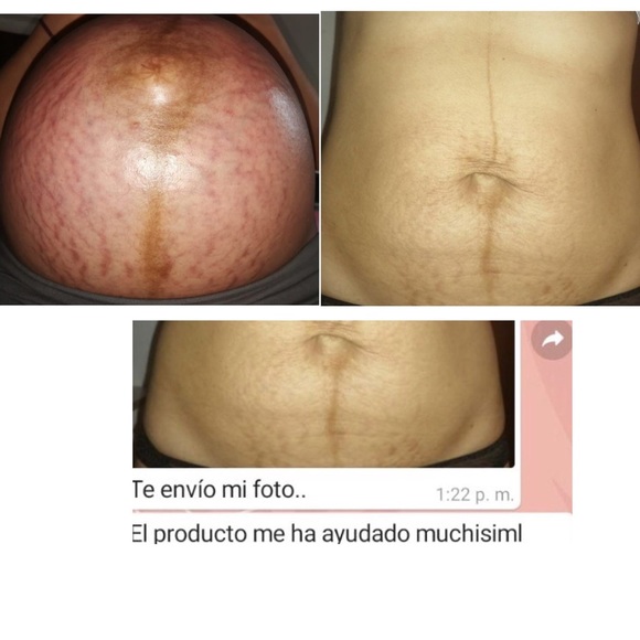 Meet your Posher, MB Distributor, LLC - Picture 4 of 17